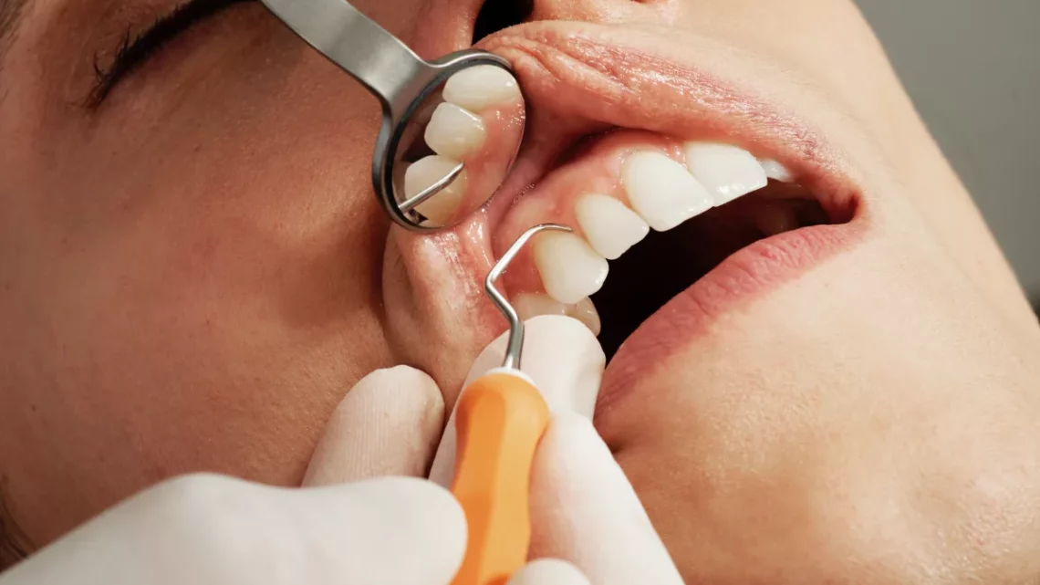 Todo sobre la periodoncia en Sevilla: Cuidado y tratamiento de las encías